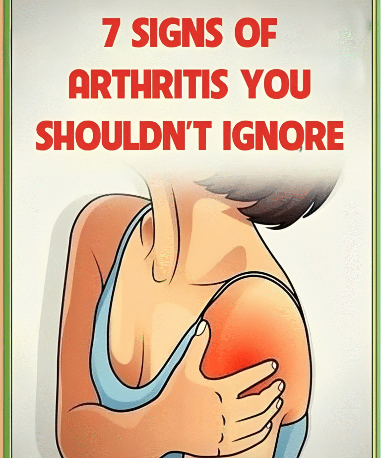 7 tecken på artrit du inte bör ignorera