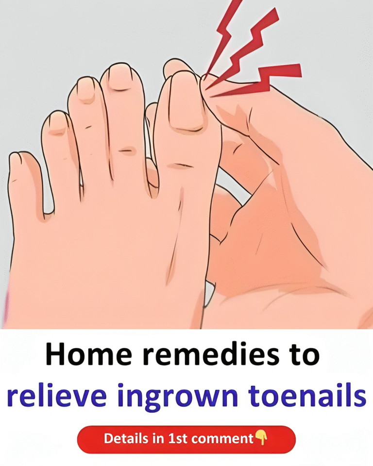 Huskurer för att lindra nageltrång