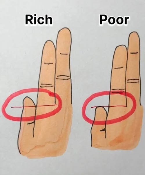 Your Fingers Could Reveal Whether You’re Rich or Poor