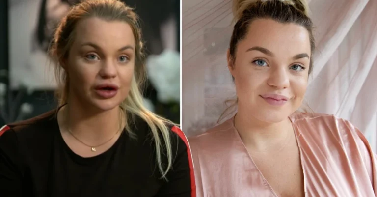 Läkarnas teori: Örhänge orsakade Lundells sepsis