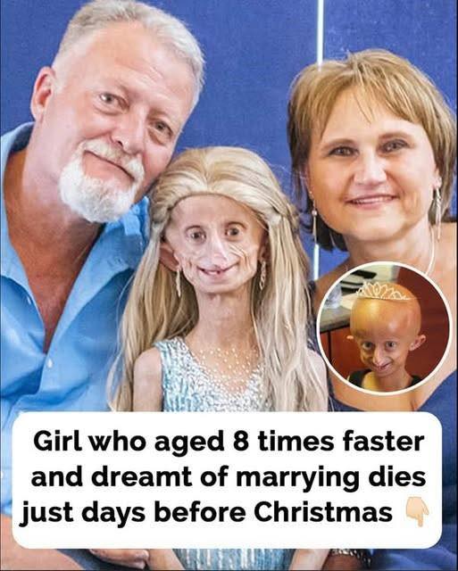 Beandri Booysen: Girl in South Africa with progeria dies