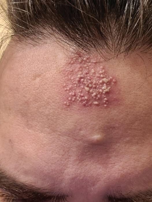 MENU These are the consequences of sleeping with…See more