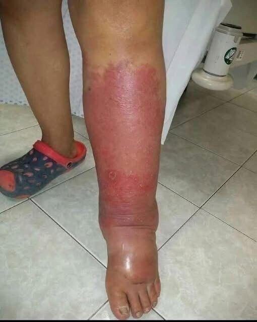 Signs on your FEET that indicate he is cr… see more