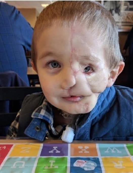 Boy, 5, survives savage attack by two …