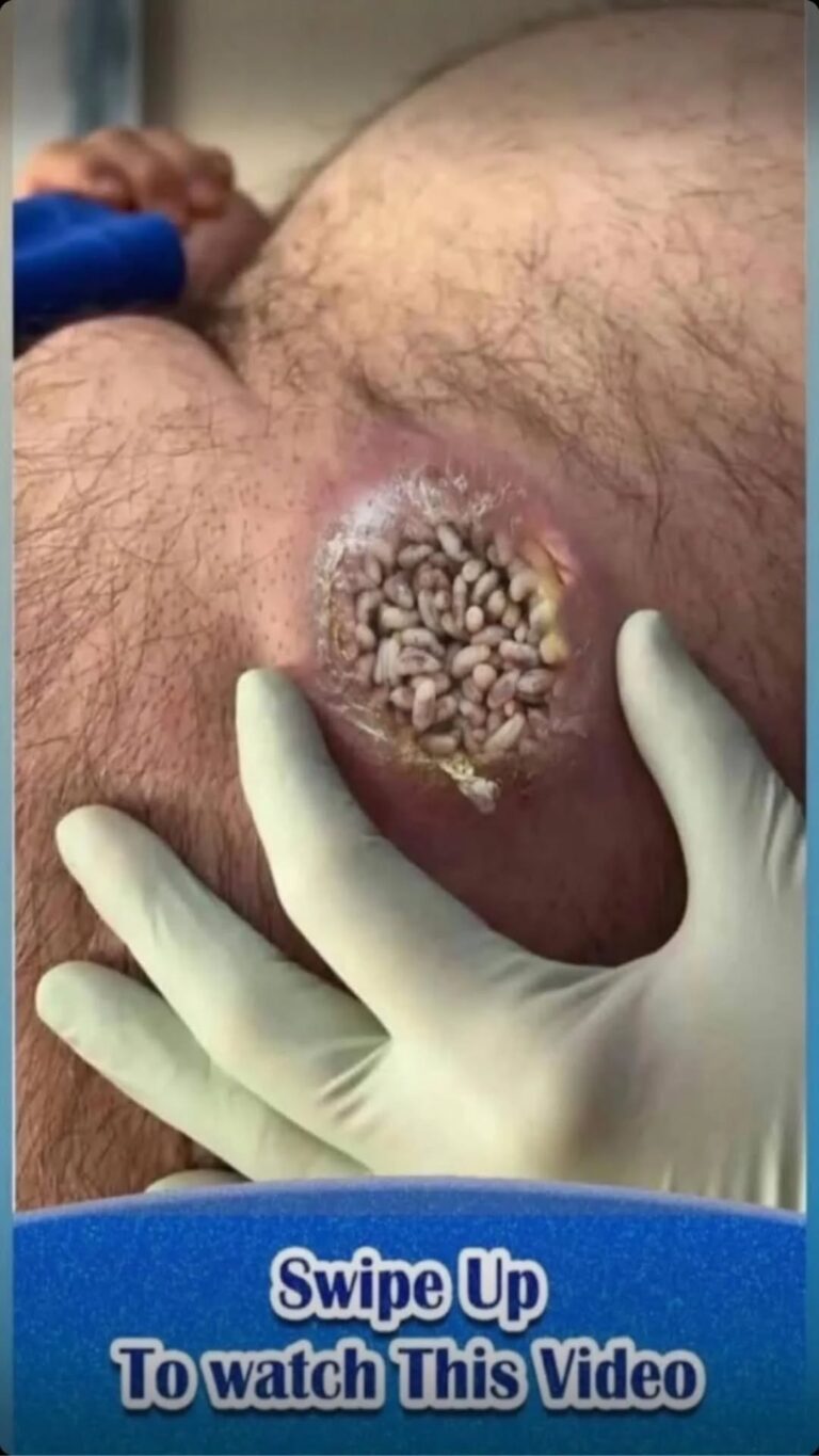 8 ALARMING SKIN SIGNS YOU CAN’T I