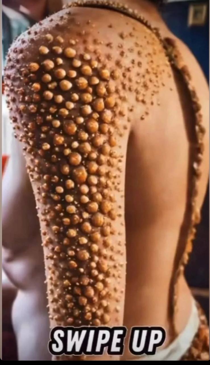 10 Signs Showing Something Is Wrong in Your Body