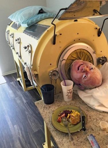 76-year-old man, paralyzed from polio at 6, was one of the last people with an iron lung: ‘My life is incredible’