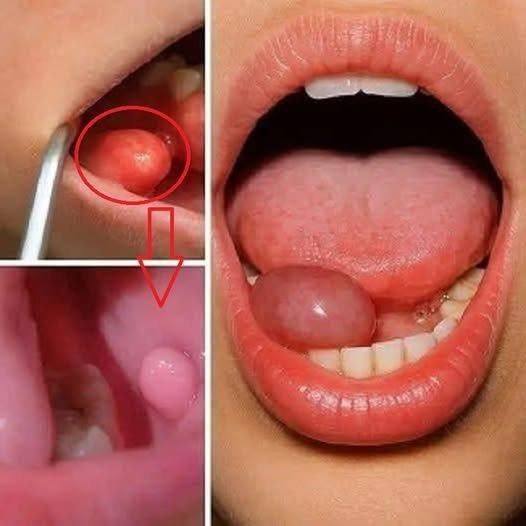 These are the first symptoms of a… See more