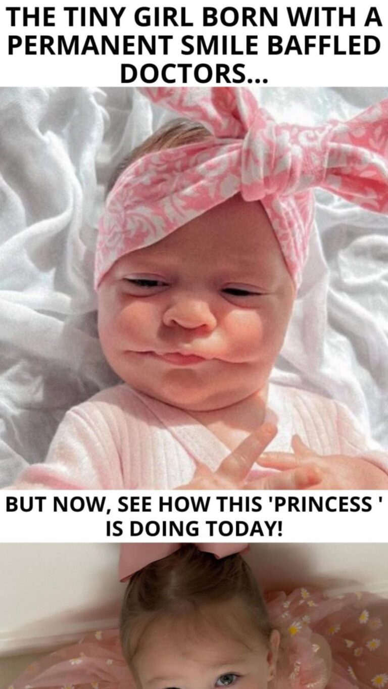 Parents Stunned by Baby’s Ear-to-Ear Smile – The Shocking Diagnosis That Left Everyone Speechless
