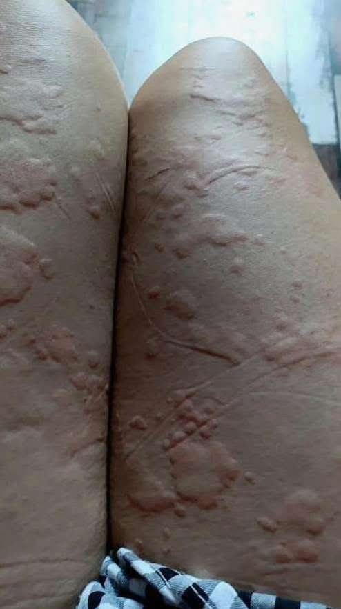 HT! These are the consequences of sleeping co! See more