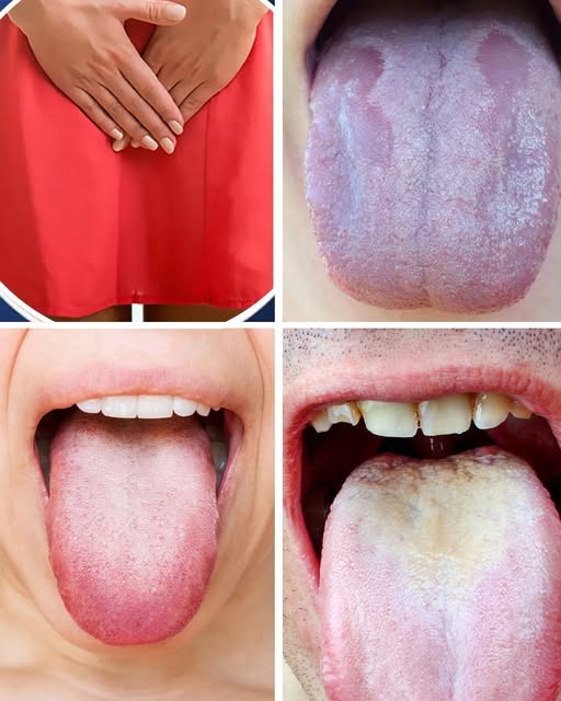 What Your Tongue Can Reveal About Your Health: 5 Warning Signs You Shouldn’t Ignore