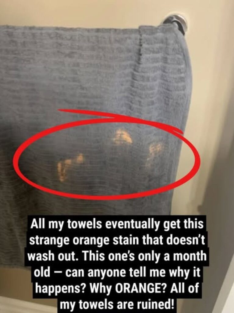 How to Recognize and Prevent Unexplained Lightened Stains on Towels