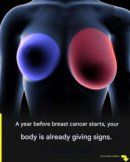 Breast cancer: 4 early signs every woman should know