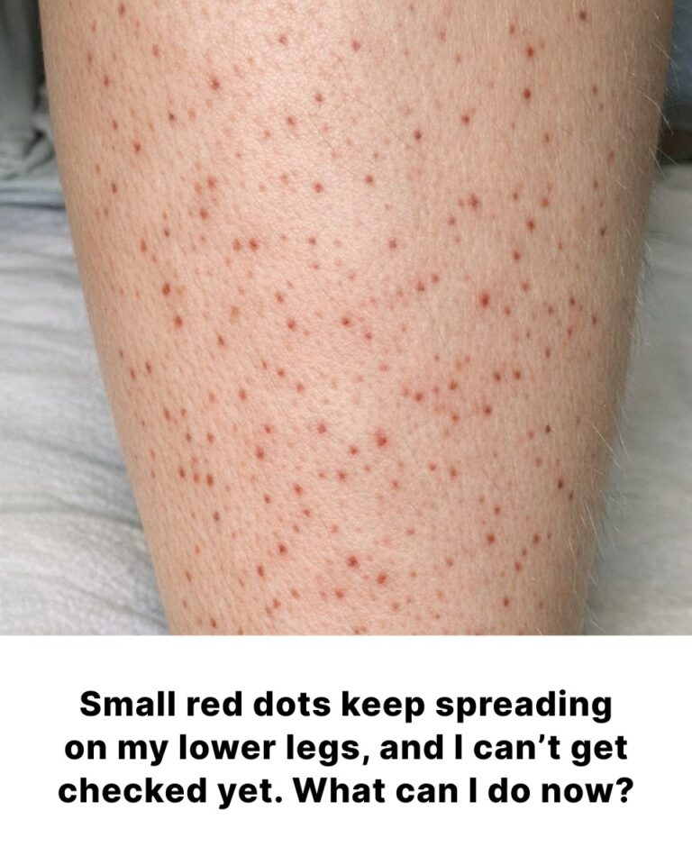 Small red dots keep spreading on my lower legs, and I can’t get checked yet. What can I do now?