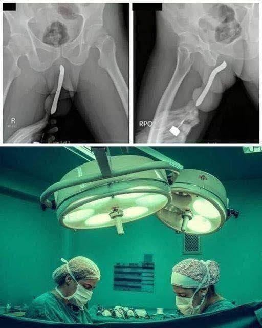 Girl had to be hospitalized for wanting to use a pe..