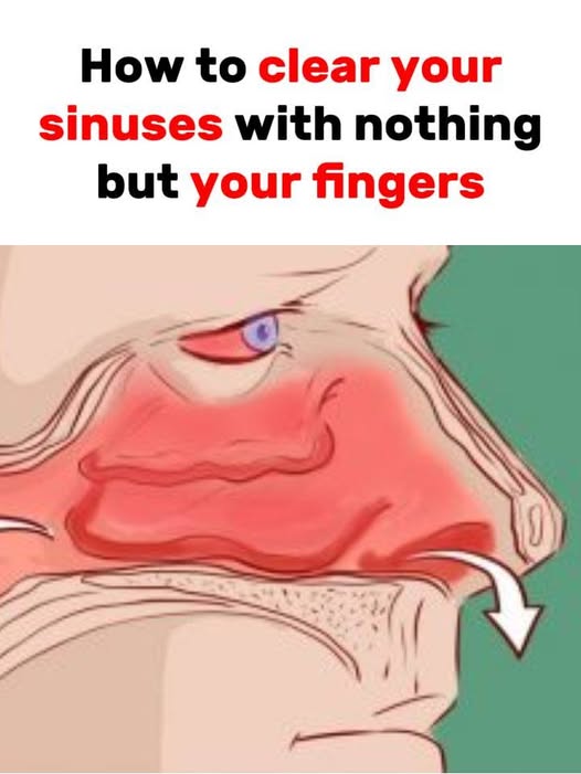 Clear Your Sinuses Instantly Using Just Your Finger