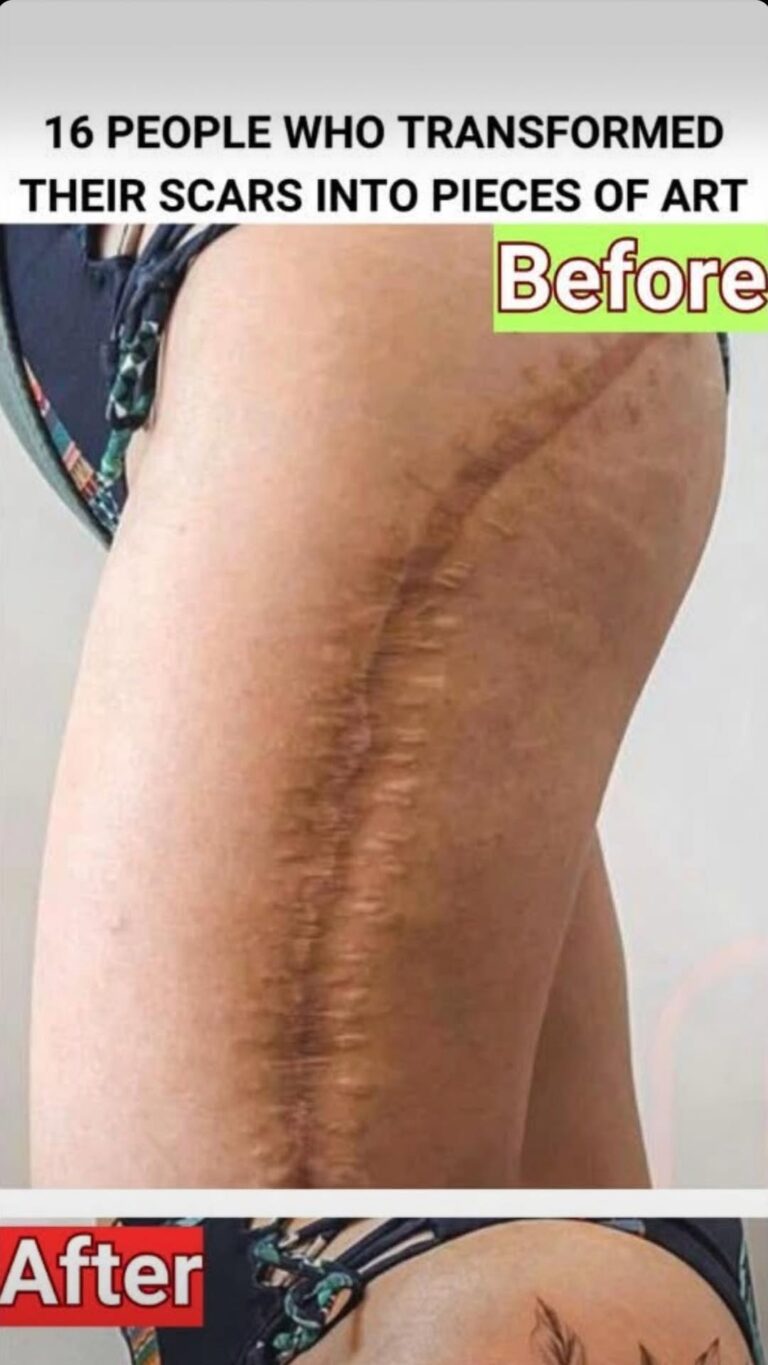 TATTOS that help turn your scars into something beautiful