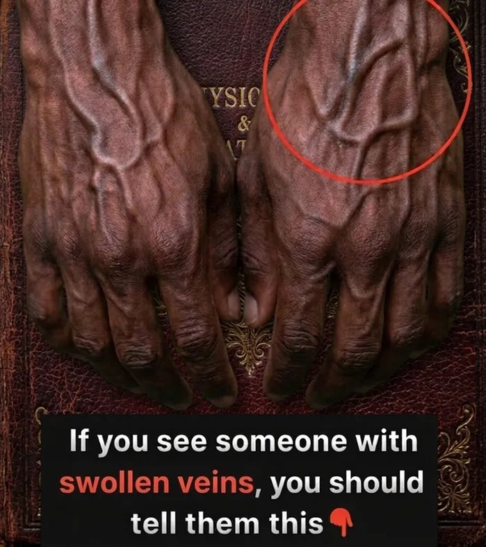 What Visible Veins on Your Hands May Say About Your Circulation and Overall Health!