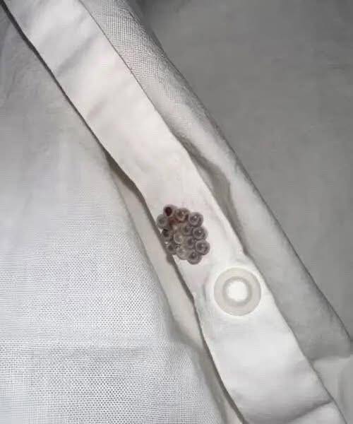 I found these tiny balls in my bed and nearly had a heart att.ack: here’s what they were