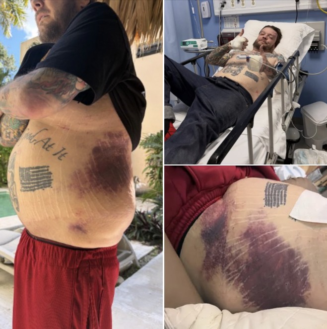 ‘Pawn Stars’ Corey Harrison issues plea to fans after near-death accident