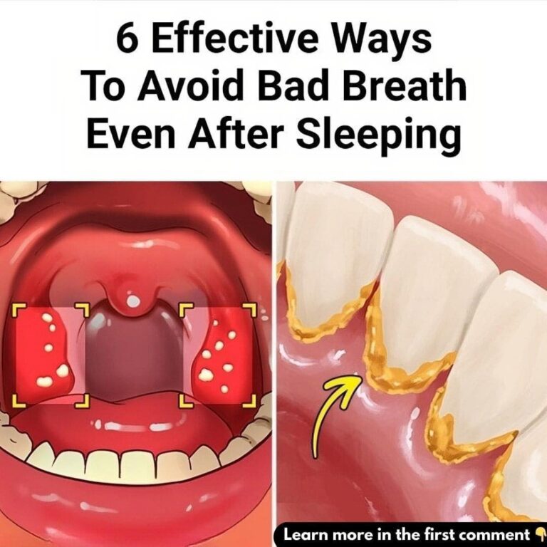 6 Proven Ways to Avoid Bad Breath