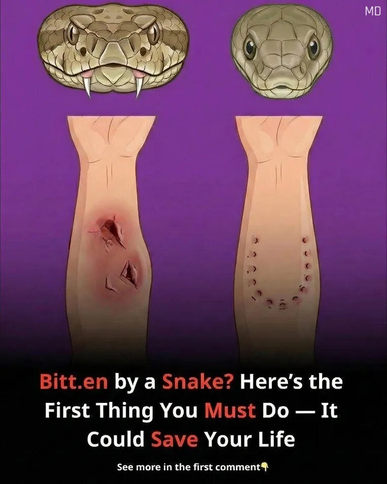 What to Do After a Snakebite: Essential First Aid Steps That Can Make a Difference