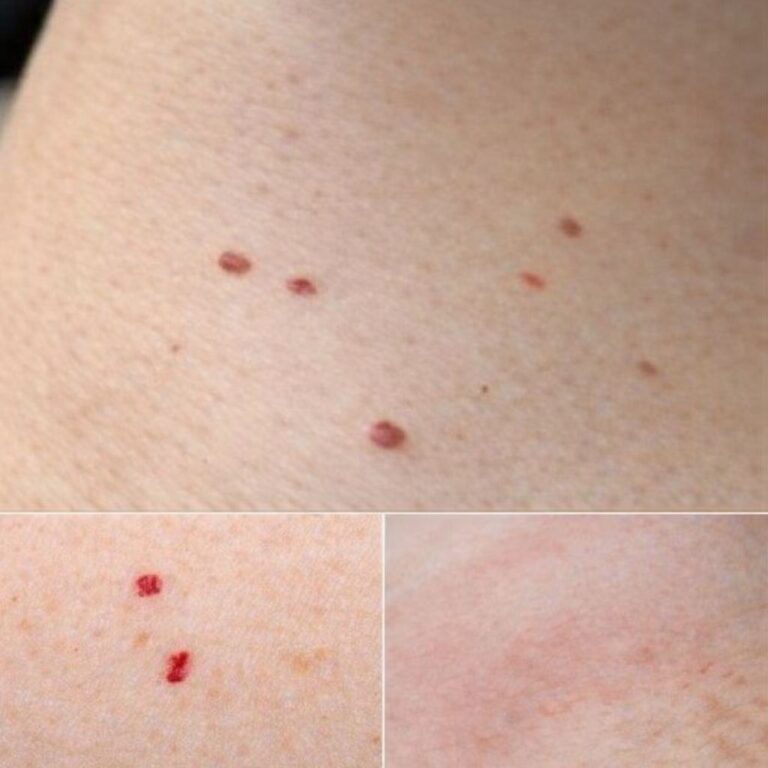 Red Dots on Your Skin – Causes and What They Could Mean!