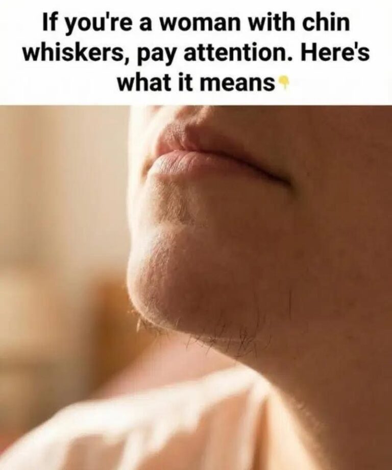 The Chin Hair, Warning, Why That One Stubborn Black Hair Is the Secret Signal Your Body Is Sending About Your Hormonal Health, and When to Worry!
