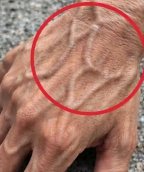 If you have visible veins, it means you are…