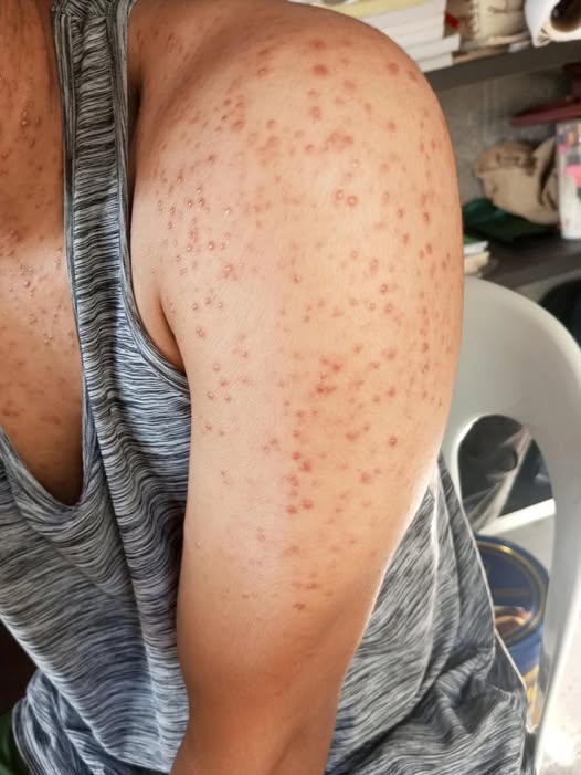 These are the consequences of sleeping with…