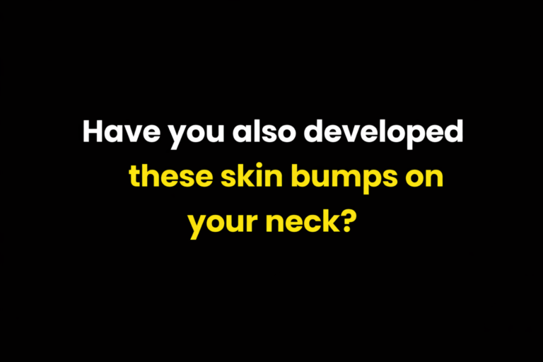 Why Do Skin Tags Suddenly Appear? 6 Common Causes Doctors Talk About