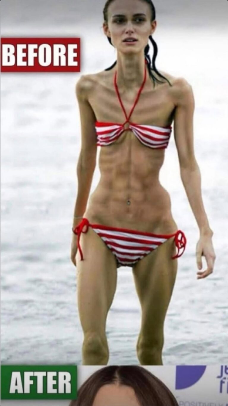 “Body Transformation: When Weight Loss Signals a Health Concern”