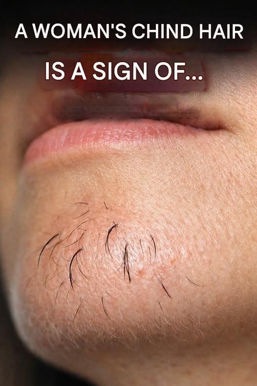 A woman’s chin hair is a sign of…See more
