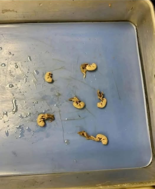 What You Should Know About the Safety of Popular Packaged Snacks