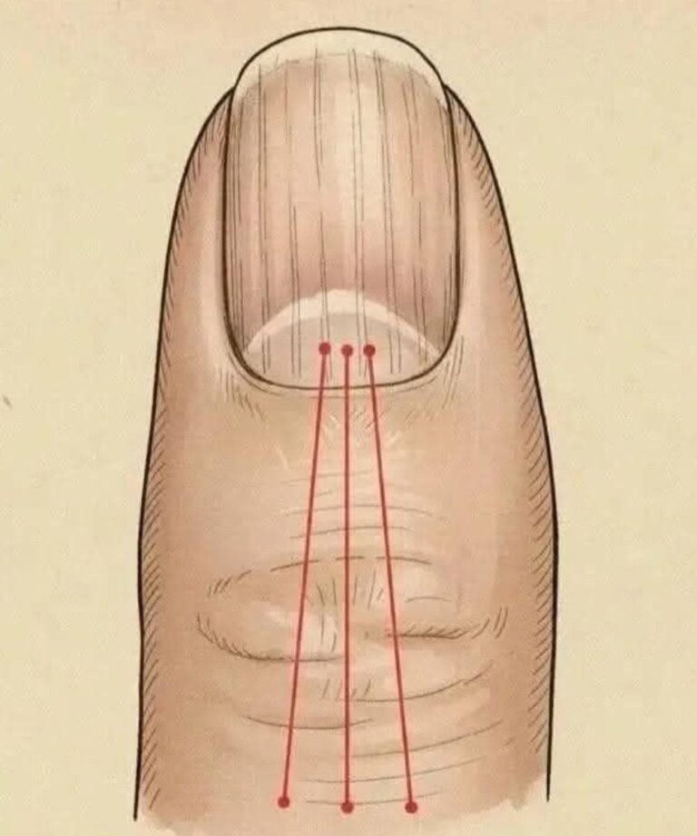 If you have these lines on your nails, you should pay attention.