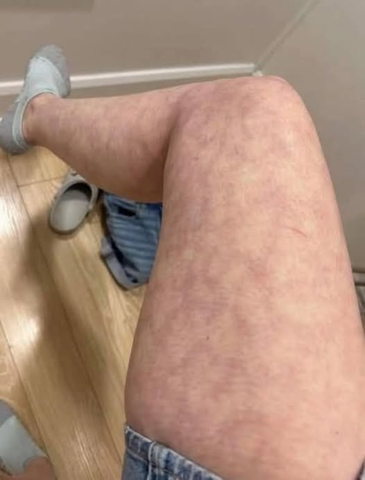 These Are the Consequences of Sleeping With a Condom… See More