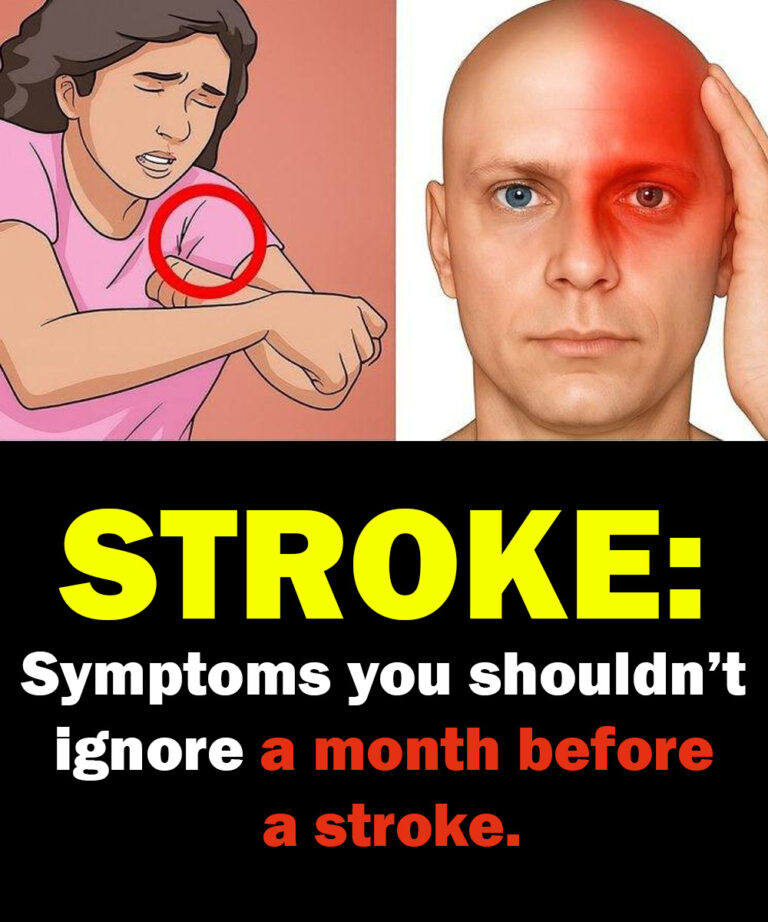 ONE MONTH BEFORE A STROKE, YOUR BODY MAY SEND THESE WA:RNING SIGNS — AND THEY CAN BE DIFFERENT FOR MEN AND WOMEN