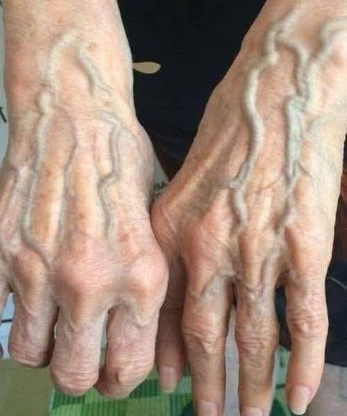If you have visible veins, it means you are…