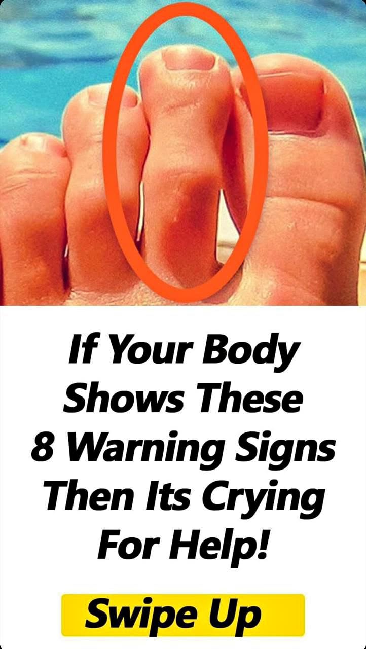 8 Warning Signs Your Body May Be Trying To Tell You Something Important