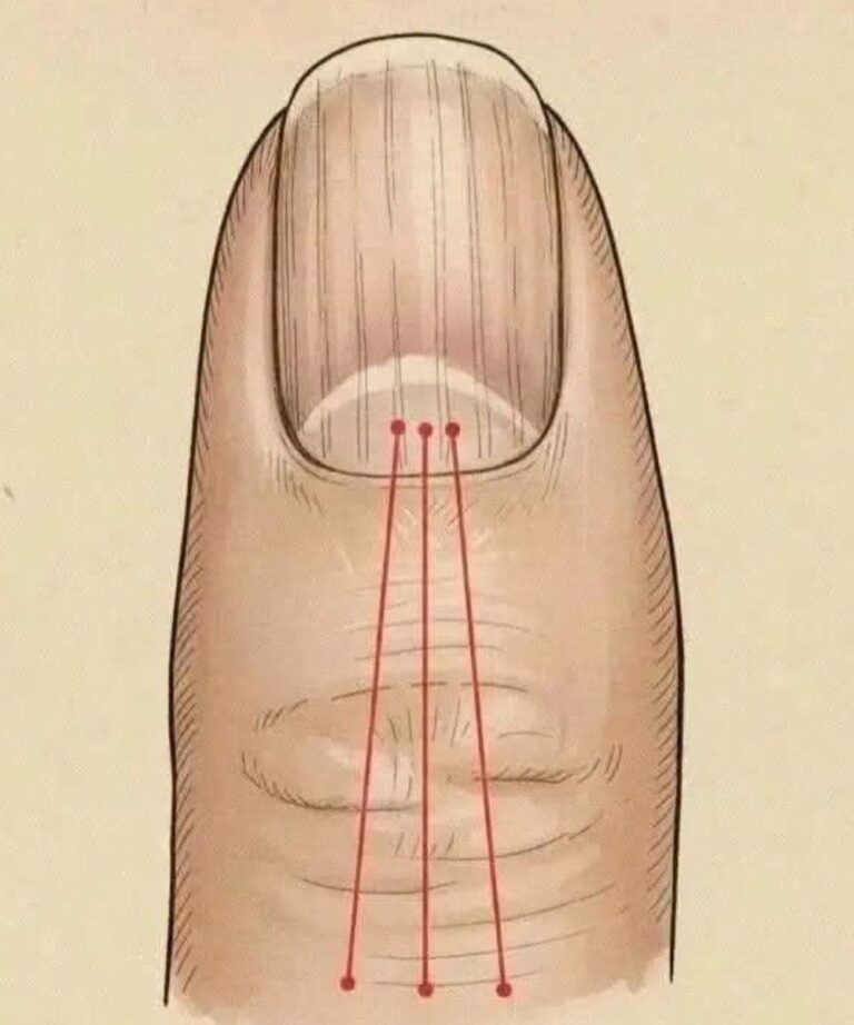 If you have these lines on your nails, you should pay attention