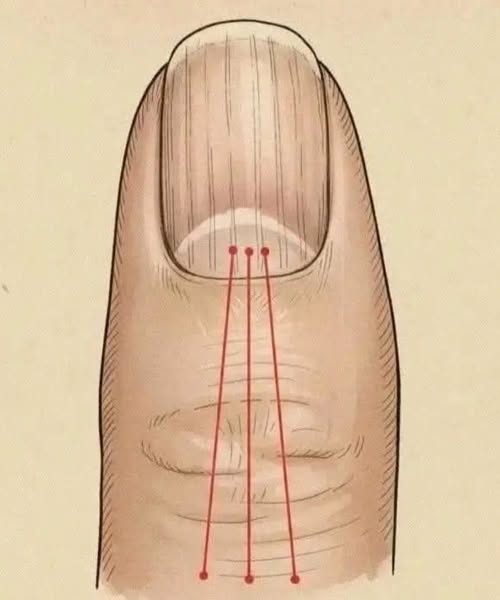 What Vertical Lines on Your Nails Can Reveal About Aging-