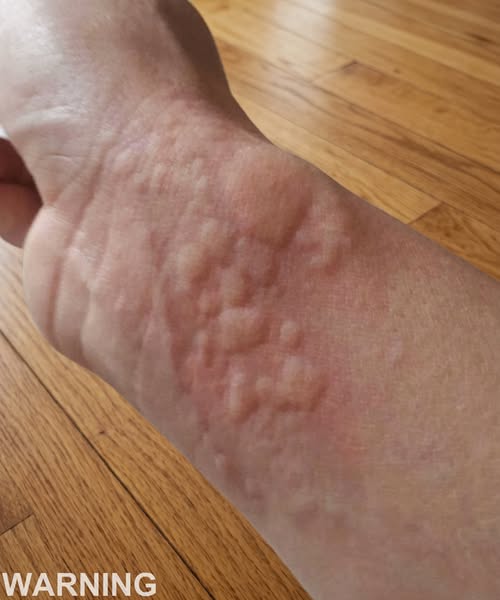 These are the consequences of sleeping with a…