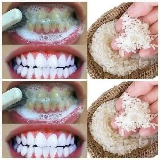 Using rice as a teeth-whitening trick has gained attention as a quick, natural smile brightener, but it comes with important caveats. Some claim that gently rubbing powdered rice can remove surface stains in just a minute