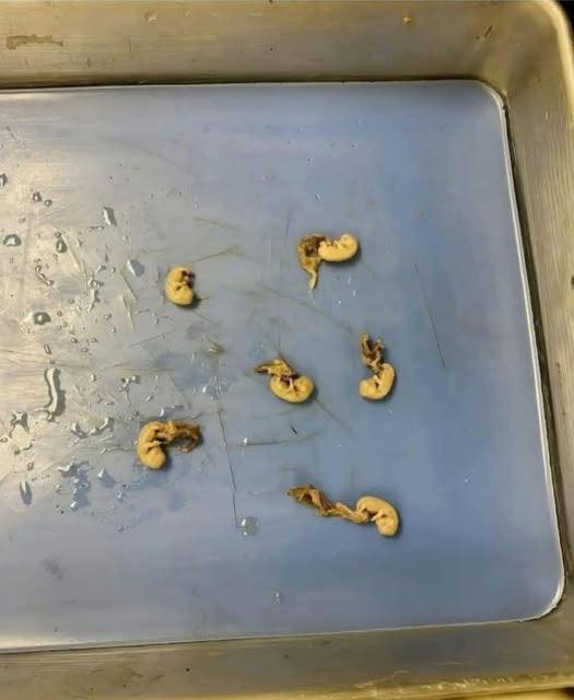 Hidden Seeds Food Warning