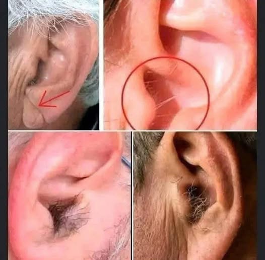 The Quiet Reason Ear Hair Shows Up Later in Life-
