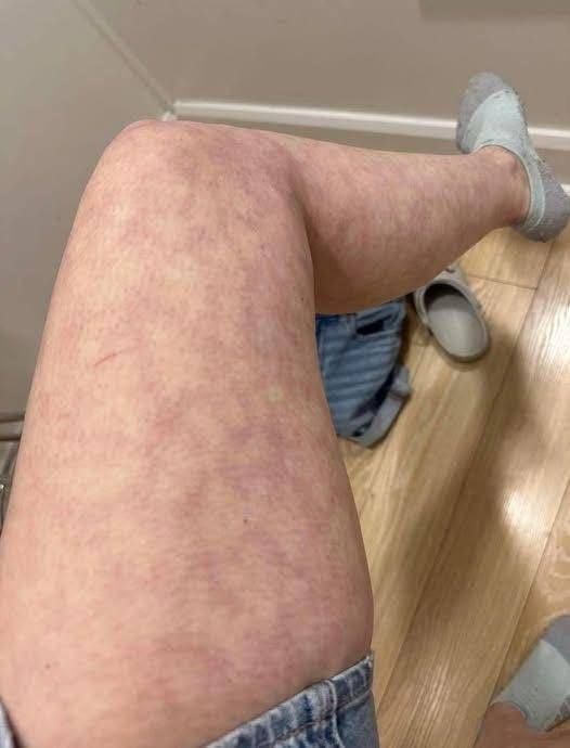 The Shocking Consequences of Sleeping With the…See more