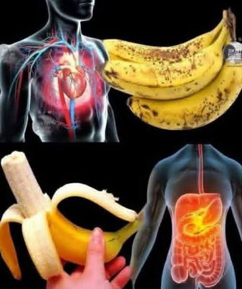 Bananas: A Popular Fruit Worth Understanding