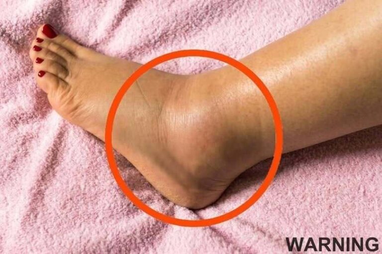 THE SILENT WARNING IN YOUR LEGS THAT DOCTORS SAY COULD SIGNAL A SERIOUS HEALTH CRISIS BEFORE IT’S TOO LATE