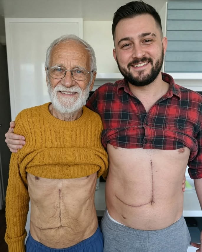 Living Liver Donation: A Profound Act of Family Love and Hope
