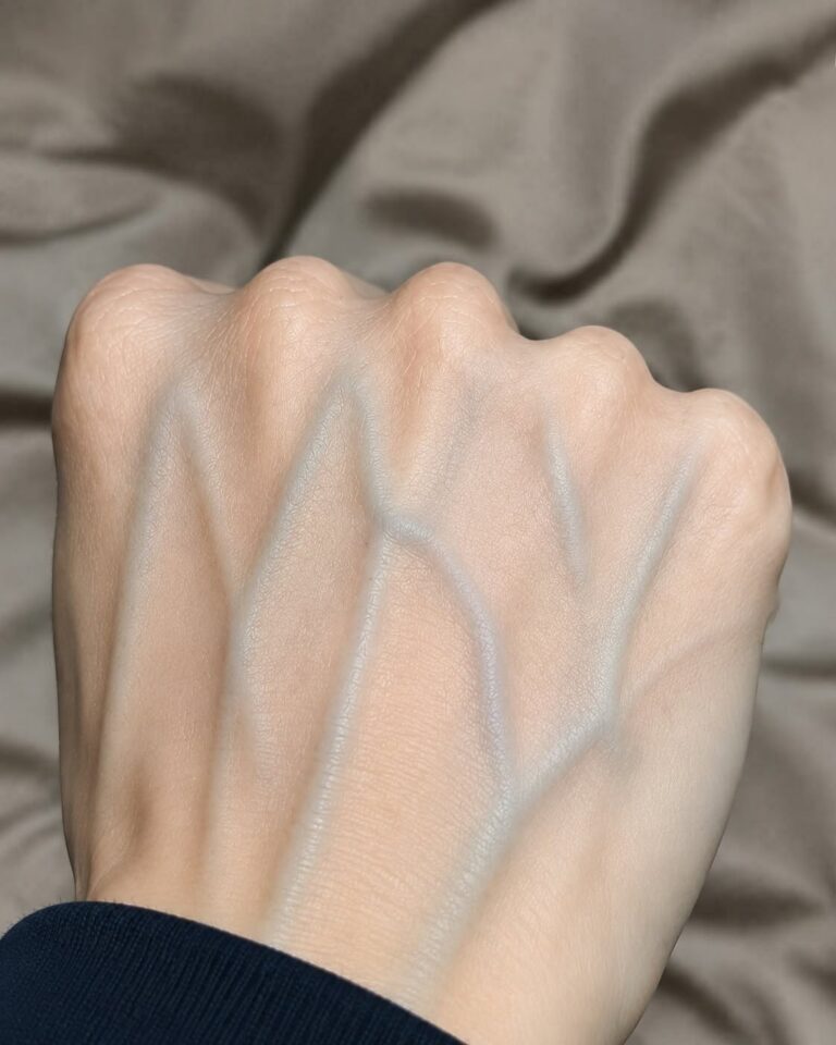 Your Visible Veins Could Be A Deadly Warning Sign You Must Not Ignore